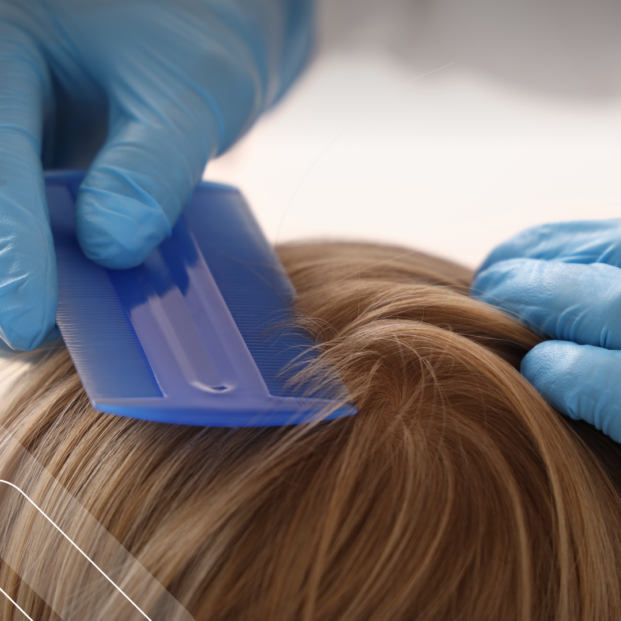 unas manos con guantes azules pasan un peine para la pediculosis por el cabello de un niño
